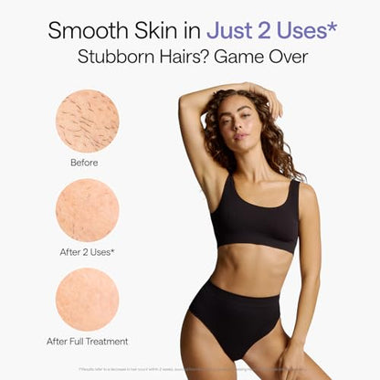 Ulike Air 10 IPL Hair Removal Device