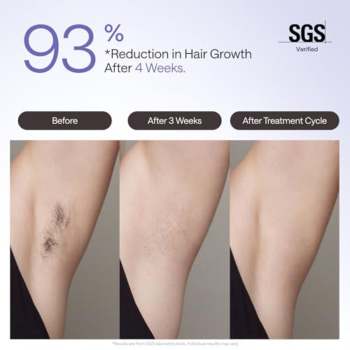 Ulike Laser Hair Removal Device Air 4 IPL for Women and Men