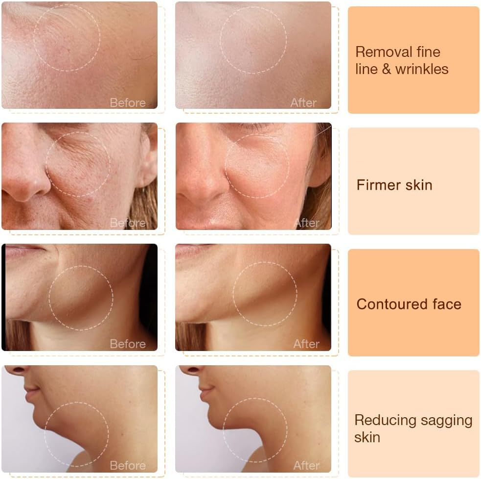 Hot & Cold Facial Therapy Device with Vibration Modes