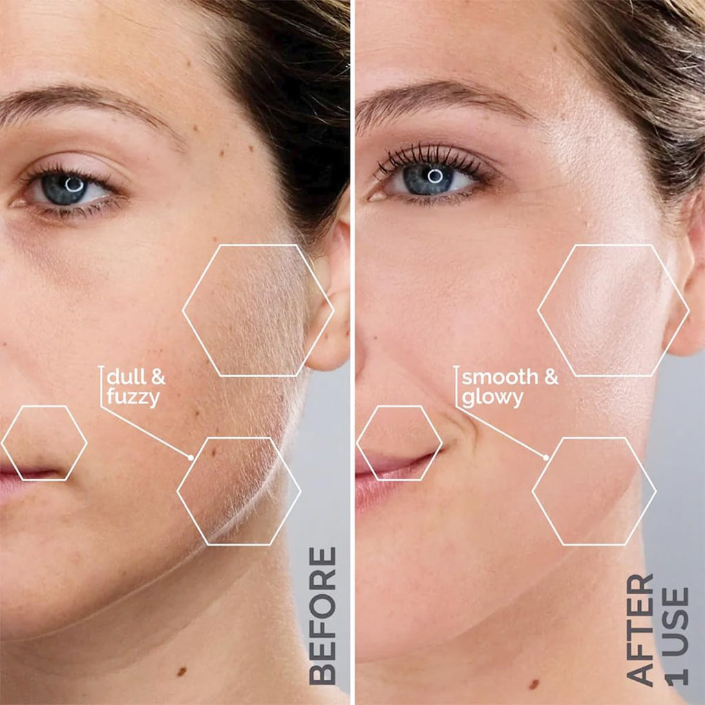 Sonic Dermaplaning & Facial Exfoliation System