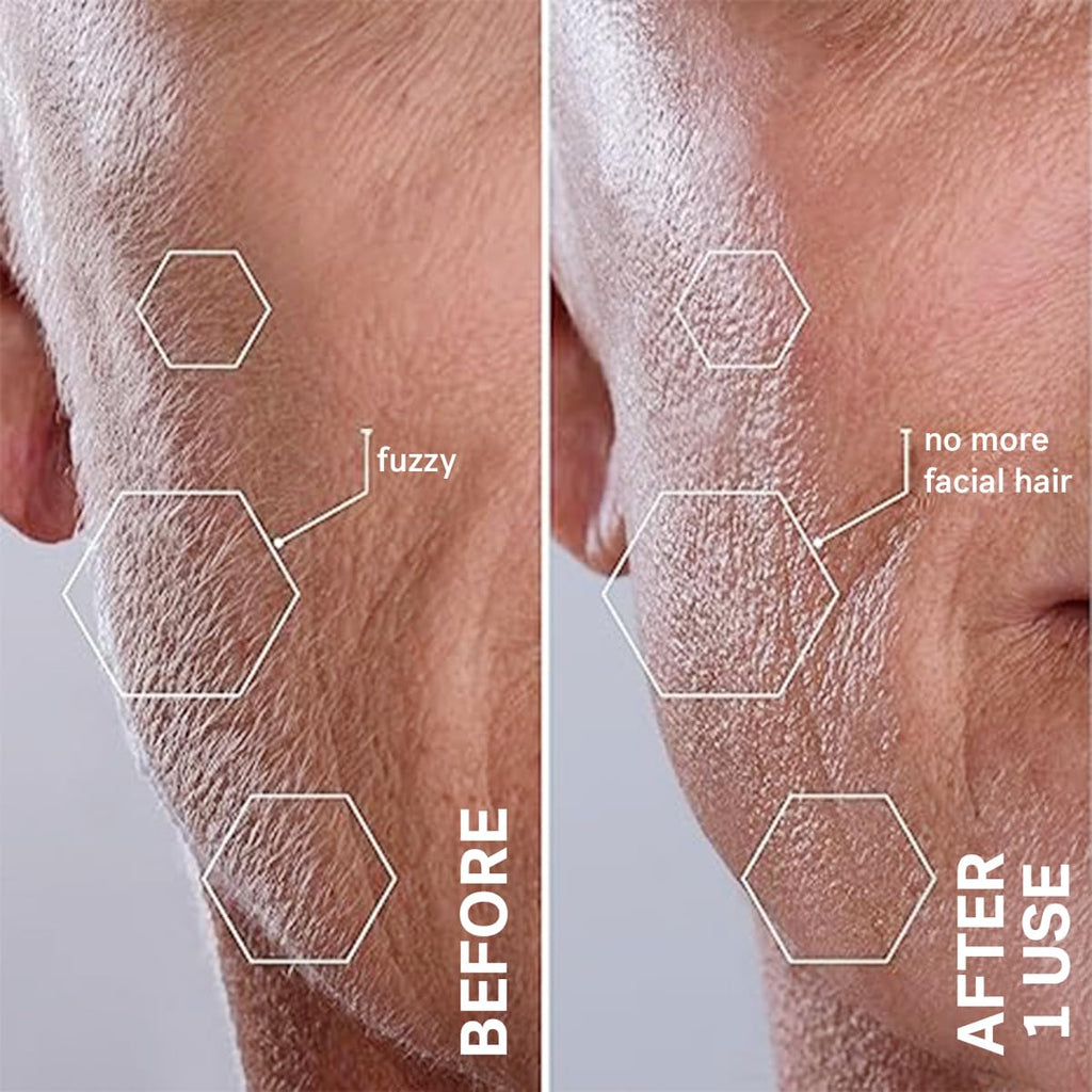Sonic Dermaplaning & Facial Exfoliation System
