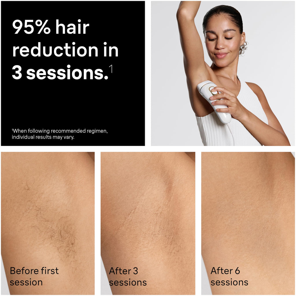 IPL Hair Removal Device with 4 Treatment Heads