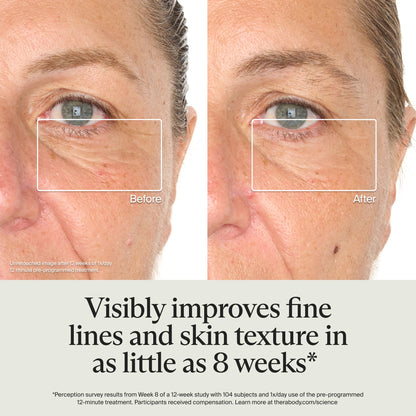 TheraFace Cordless LED Skincare Face Mask by Therabody