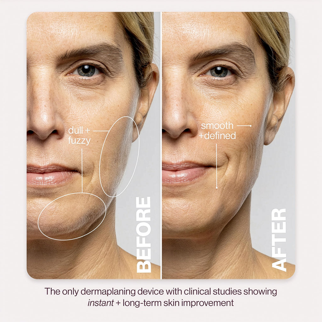 Sonic Dermaplaning Tool for Facial Exfoliation & Hair Removal