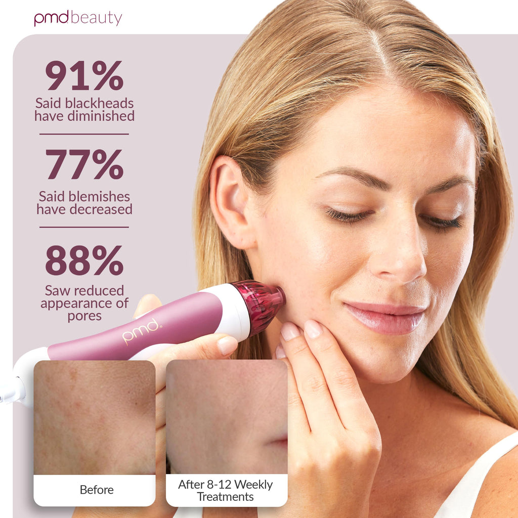 Microdermabrasion Face & Body Exfoliation Device